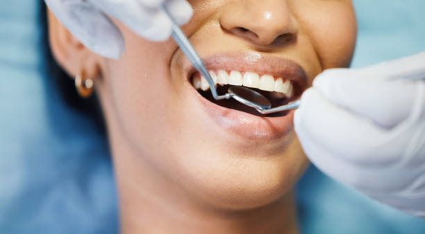 Best Knocked-Out Tooth Emergency  in Pittsboro, NC